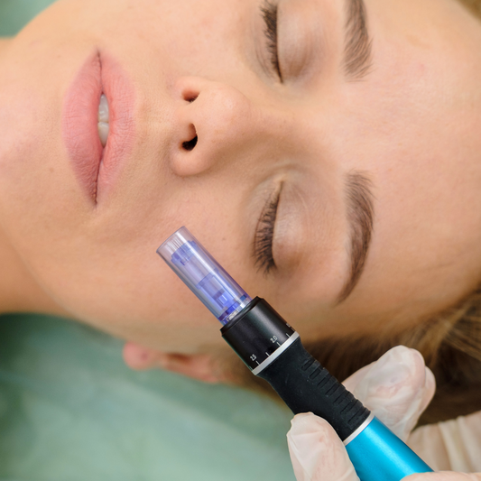 Microneedling vs plasma rico en plaquetas